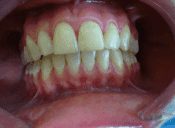 ortodoncja saska kępa